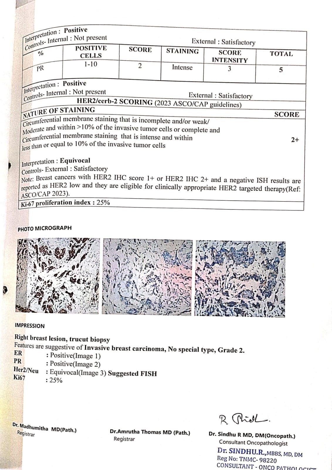 Biopsy Report thumbnail 4